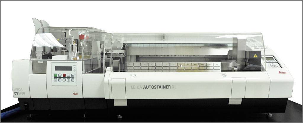 Immunoassay System